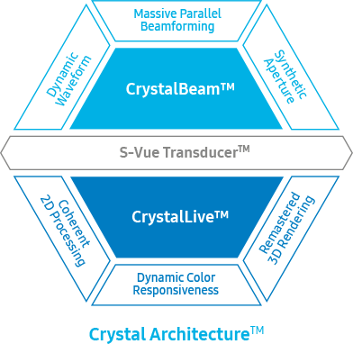 CrystalLive és CrystalBeam képalkotás az S-Vue vizsgálófejekkel