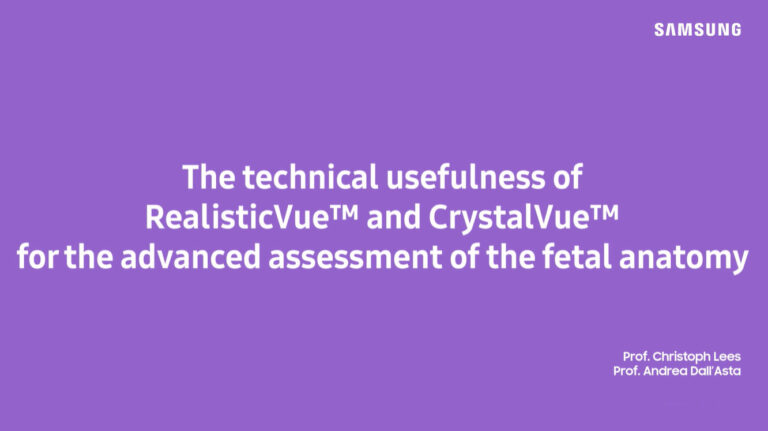 A RealisticVue™ és CrystalVue™ technikai haszna a második trimeszterben