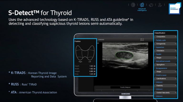 S-Detect for Thyroid