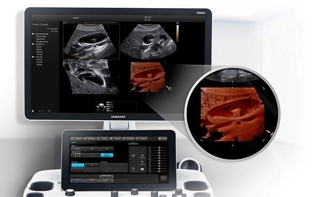 SAMSUNG RS80 Prestige ultrahang készülék Contrast enhanced ultrasound