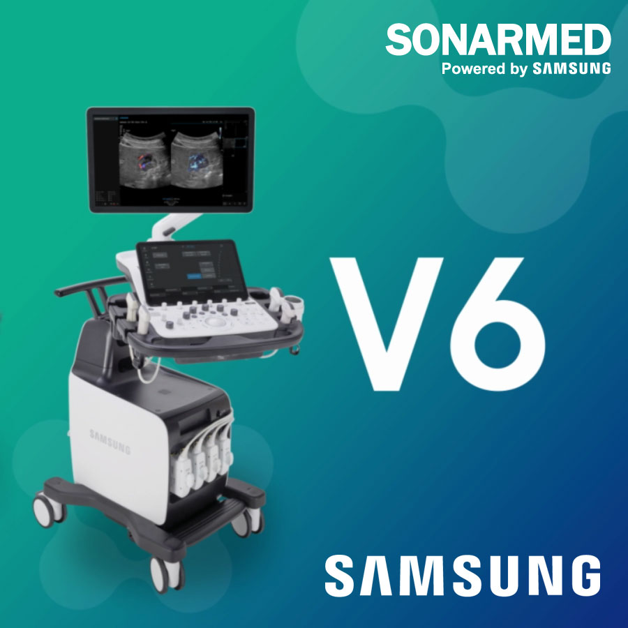 Samsung V6 ultrahang készülék