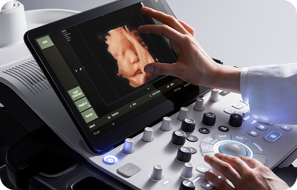 Samsung V7 szülészeti-nőgyógyászati ultrahang készülék