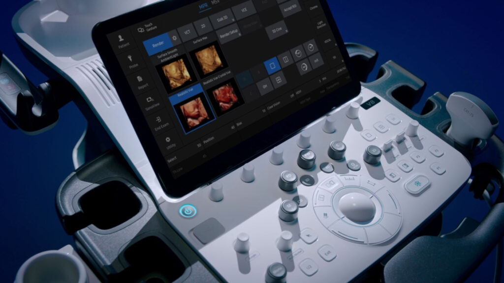Samsung V8 ultrahang-diagnosztikai készülék szülészeti-nőgyógyászati célra