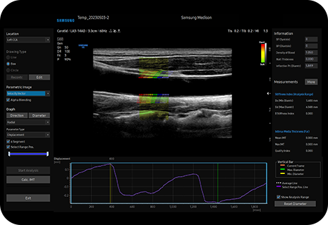 Samsung ultrahang készülékek - ArterialAnalysis™