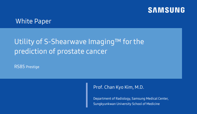 Utility of S-Shearwave Imaging™ for the prediction of prostate cancer
