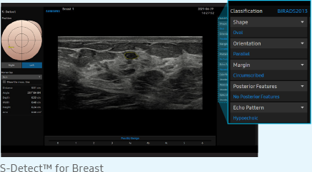 S-Detect™ for Breast - Emlőszűrés