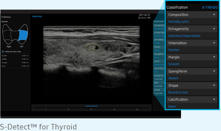 S-Detect™ for Thyroid - Elemezze a kiválasztott pajzsmirigyelváltozásokat és készítsen jelentést a pajzsmirigy felméréséről